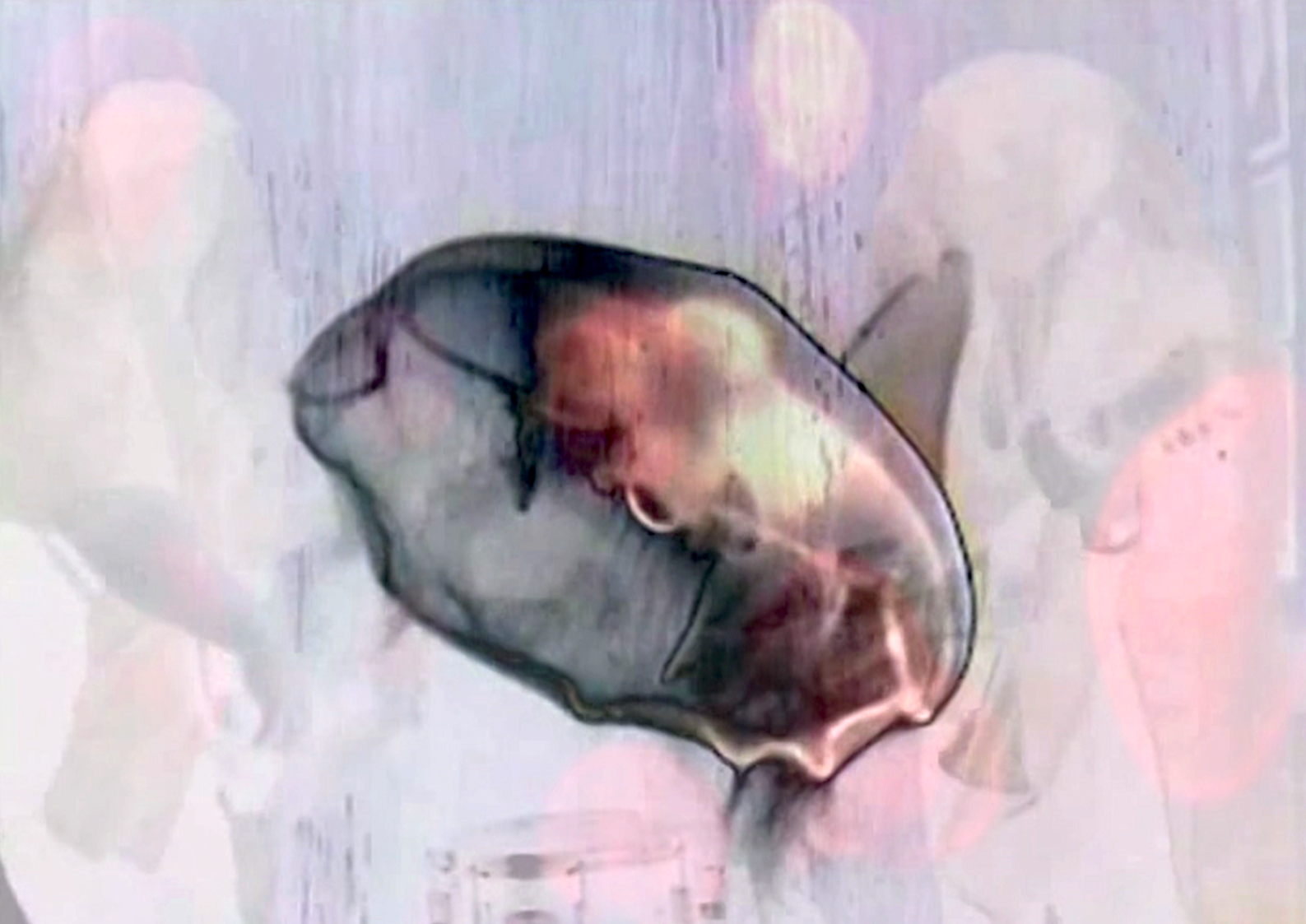 Save The Jellyfish 7